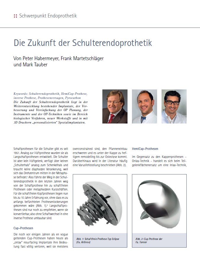 Die Zukunft der Schulterendoprothetik