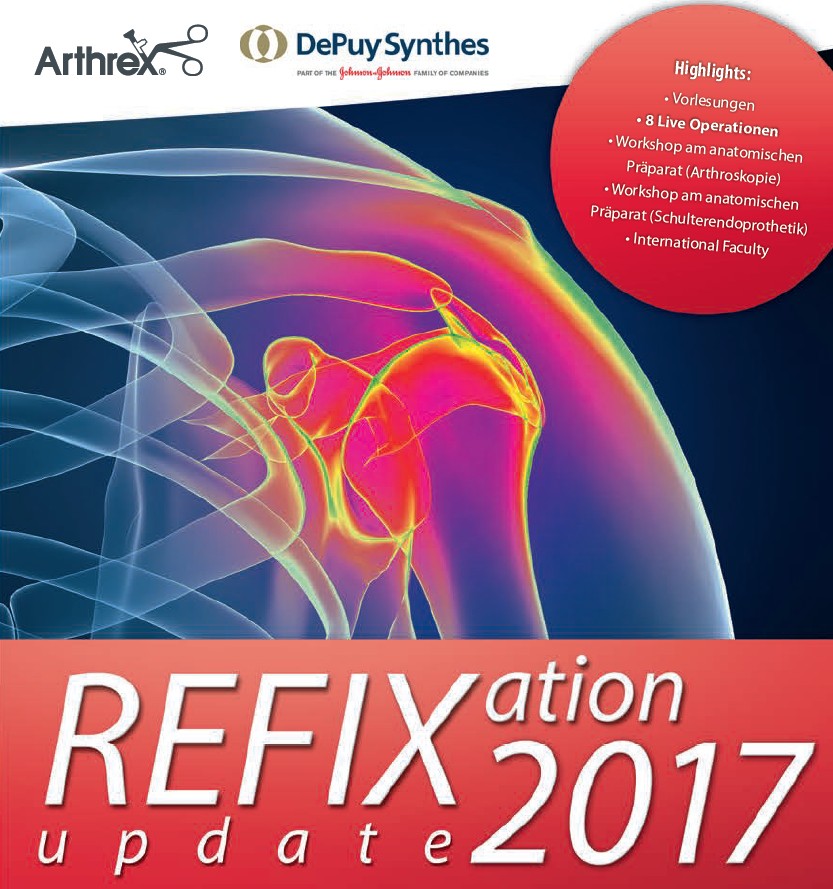 Refixation Update 2017 Titel