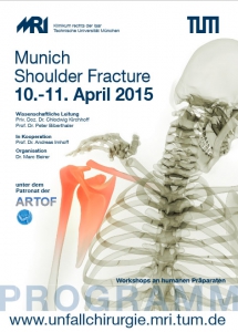 Munich-Shoulder-Fracture-Apr-2015a