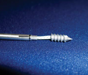 Abb 05 Titananker mit 2 Fadenpaaren eines sehr reißfesten Fadens